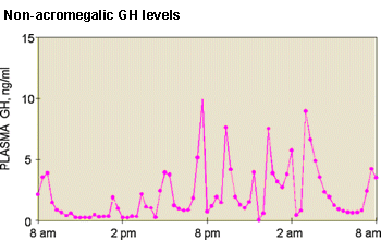 gh acromegaly