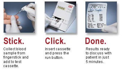 cholestech ldx