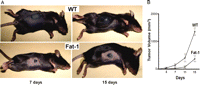 b16 melanoma