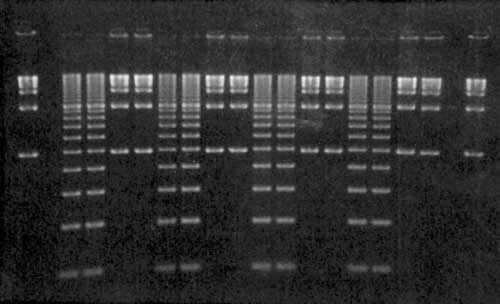 agarose tbe