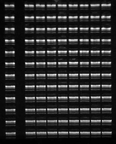 agarose tbe