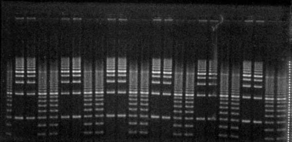 agarose tbe