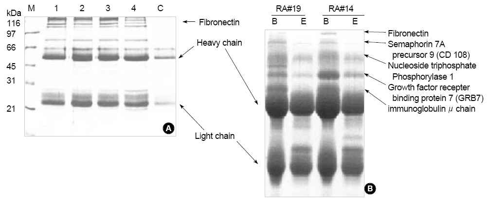 cnbr sepharose