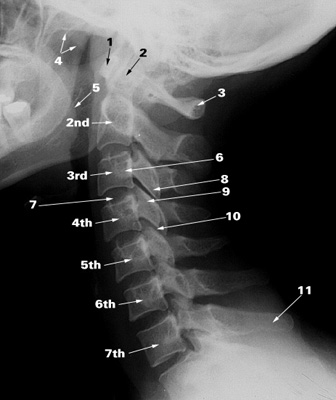 cervical c7