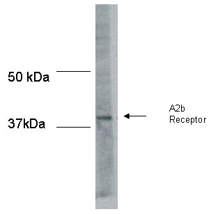 a2b receptors