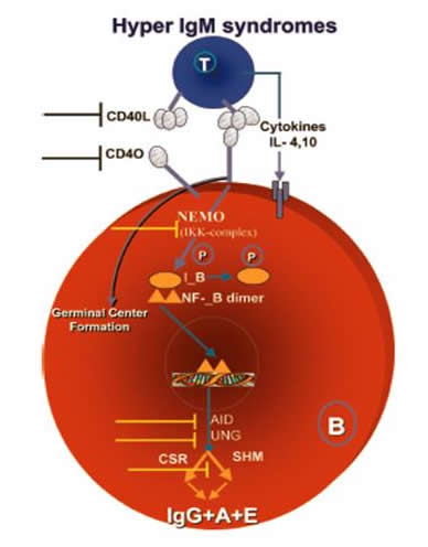 hyper igd syndrome