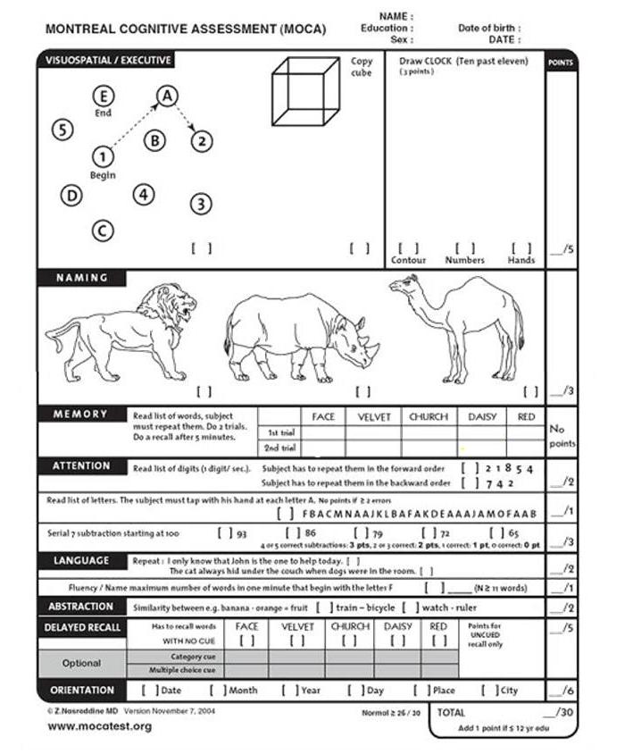 cognitive assessment