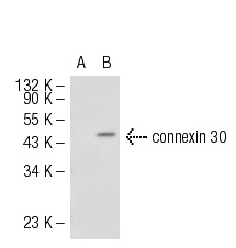 connexin 30